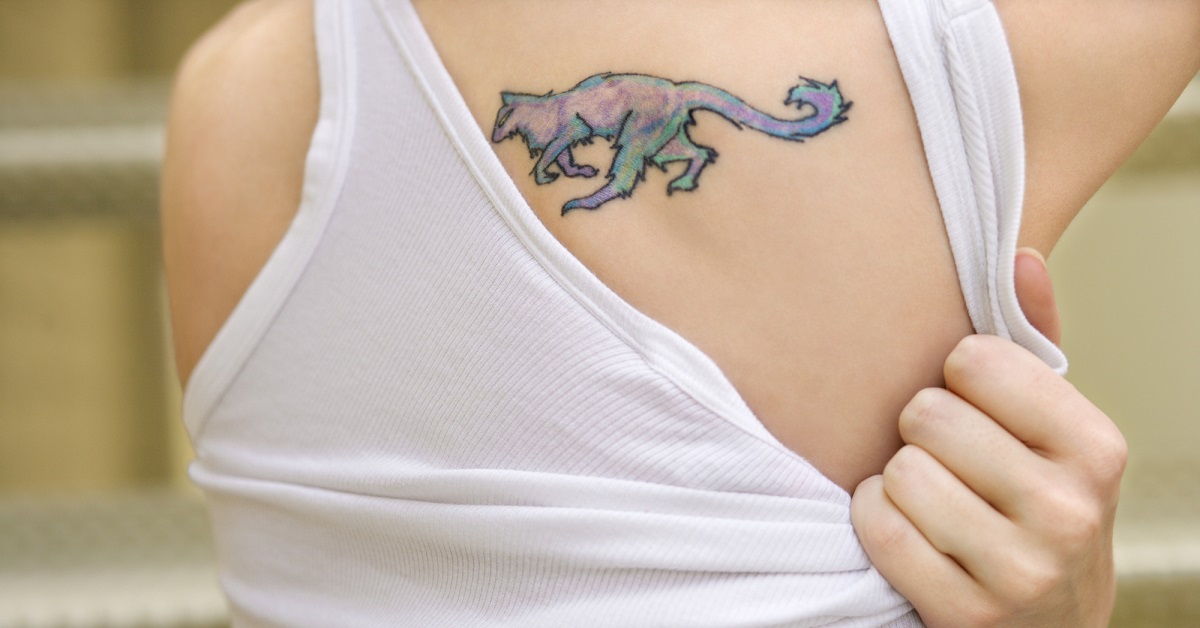 PicoSure Tattoo Removal: Revolutionizing the Art of Erasing Ink