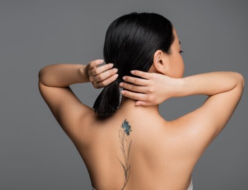 Fresh Start: Revitalize Your Look with Tattoo Removal