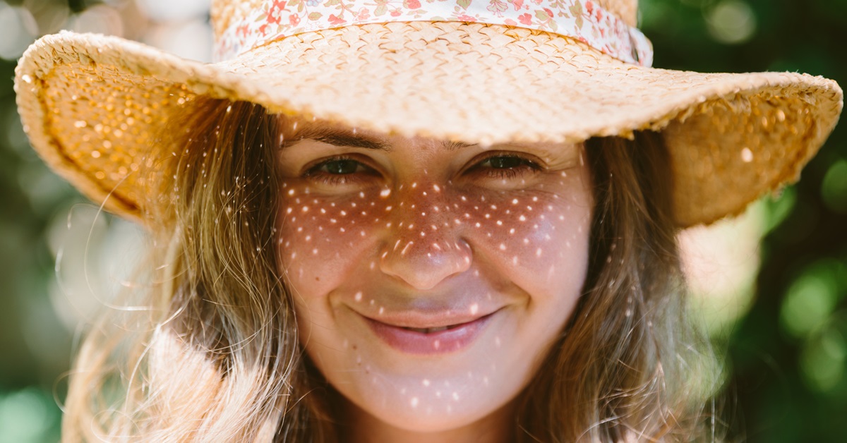 The Ultimate Guide to Summer Laser Facial Rejuvenation