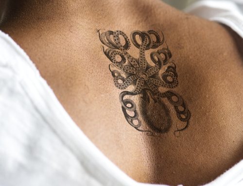 Is 2025 the Year You Finally Get Rid of That Bothersome Tattoo?