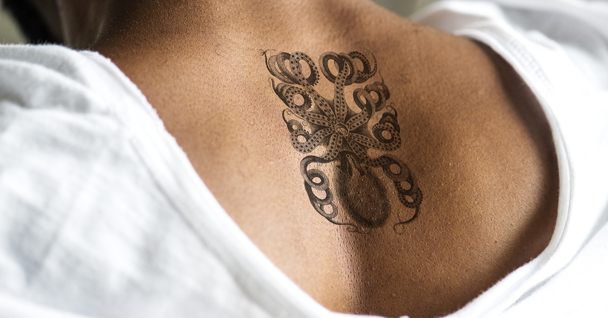 Is 2025 the Year You Finally Get Rid of That Bothersome Tattoo?